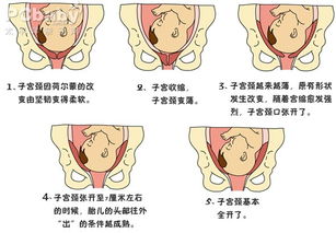 顺产全过程图片 女人生孩子的真实过程