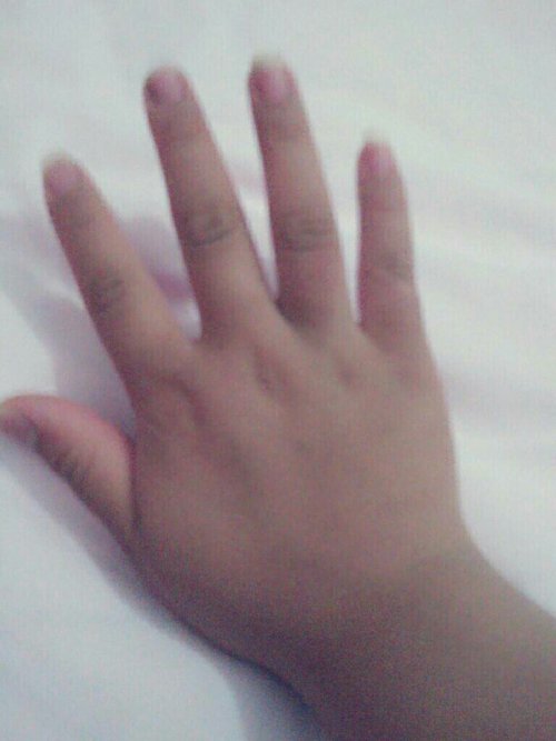 作为一个女生,手指太粗太丑,觉得都没有更丑的手了,平常都不好意思伸出来,有什么方法可以让手指变细点 