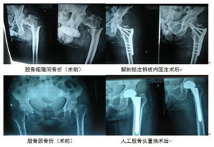 外科手術指導之顯微外科的設備和器材，關于手術器械使用ppt的信息