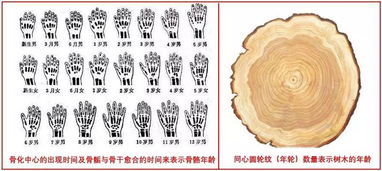 骨骼也有年龄,别错过了孩子最佳长高期