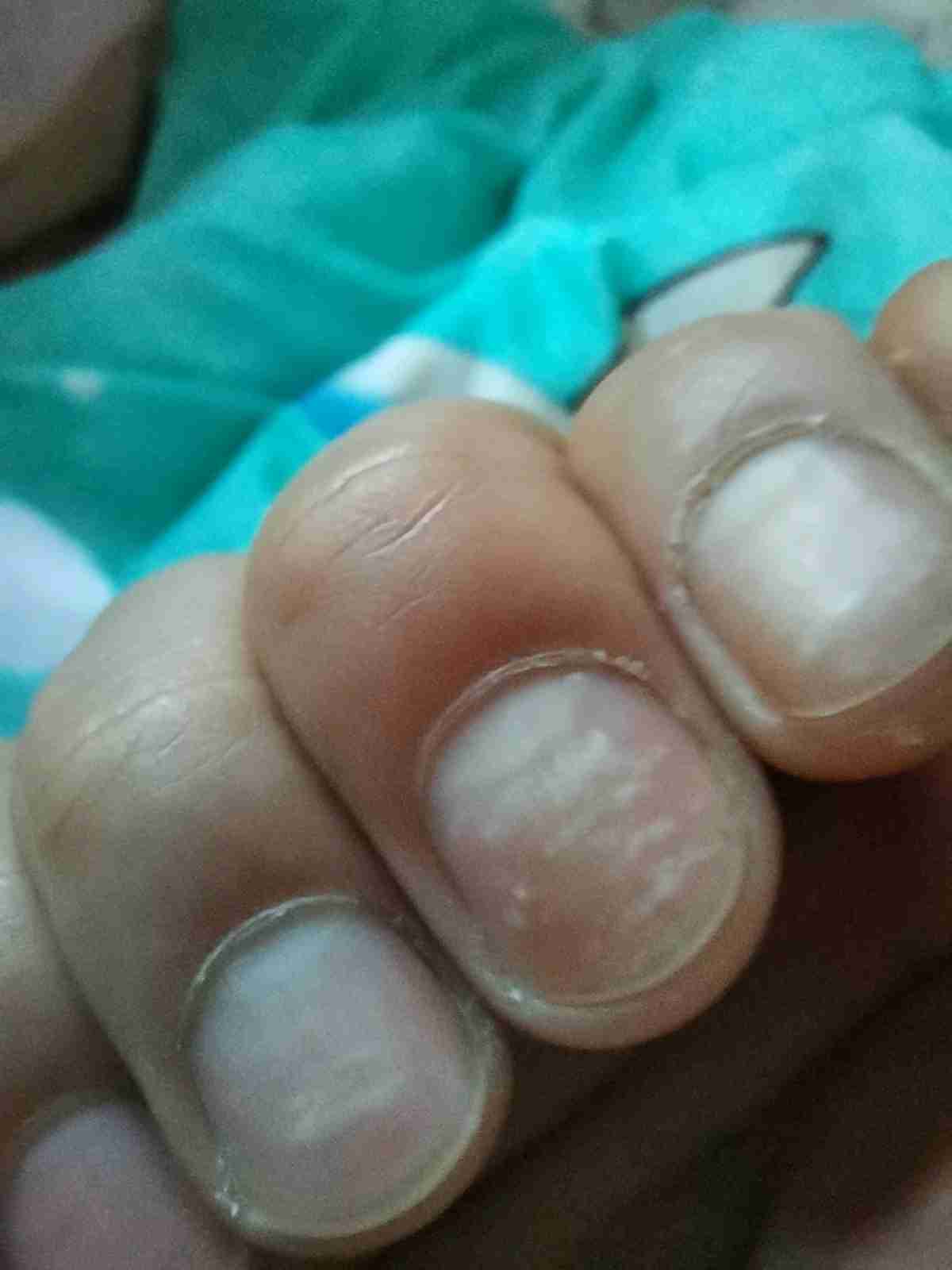 手指甲盖上的白色月牙代表什么