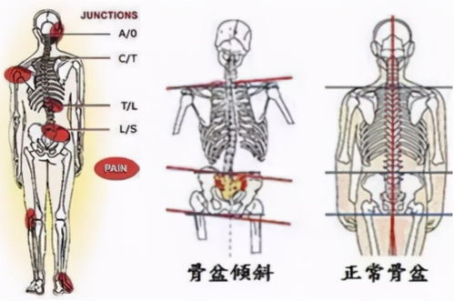 坐姿不正 小心长短腿