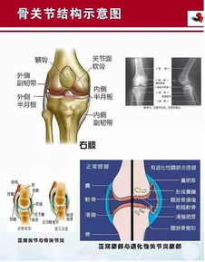 安全 有效 干细胞将成为治疗骨关节炎最有效的方式