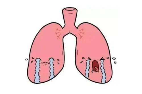 支气管炎患者不能碰的3种食物 吃1口,炎症再等10天也不好