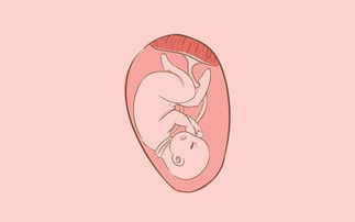胎儿脐带绕颈危害大,孕妈做好这几点,让脐带绕颈远离胎宝宝 