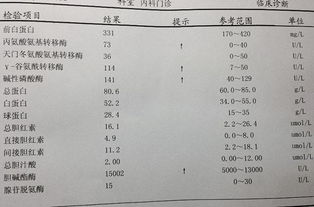 转氨酶高 坚持做好2事,2物是转氨酶 大救星 ,3个月降下来