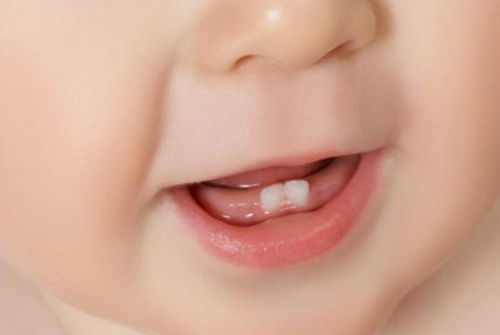 宝宝出牙早晚和咀嚼发育有关,安排好辅食添加,牙齿才能长得好
