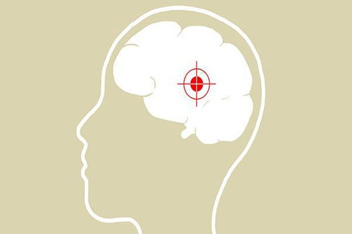 脑出血的前兆有哪些 脑出血危害大,如何预防才能远离脑出血