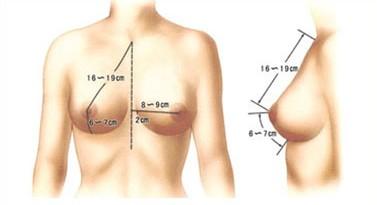 乳房悬吊手术怎么服用ACMTETEA