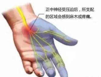 手指发麻预示着10种疾病,你还敢再大意 