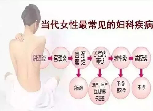 阴道：妇科疾病的阴晴表(妇科疾病示意图)
