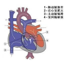 先天畸形的形成方式和类型