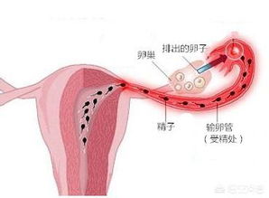 输卵管通水 输卵管通水怎么做啊