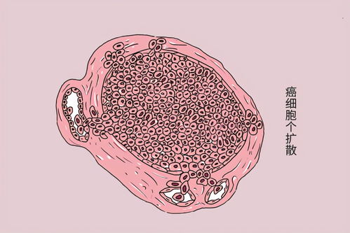 部分癌症患者,癌细胞扩散后,食欲和精神依旧很好,说明了什么