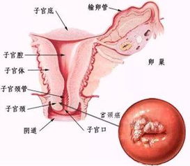 女性生殖健康知识,知多少