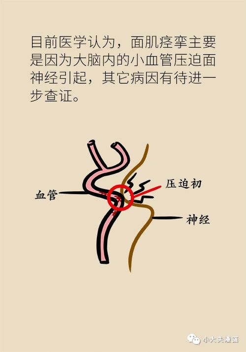 左眼跳财,右眼跳灾 要小心 可能都是神经问题