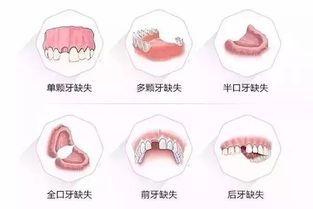 十堰29岁美女月薪1万,有房有车 结果相亲惨遭拒绝,只因...