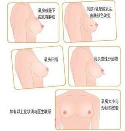 乳腺癌防治月丨关于女性第一杀手,经常用乳的你要 