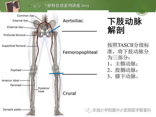 东大影像丨下肢CTA的检查流程及评价