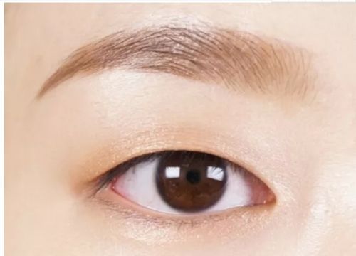 单眼皮是属於显性遗传还是隐性遗传 