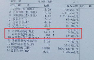 乙肝不必刻意分餐制,转氨酶升高,先别着急下判断