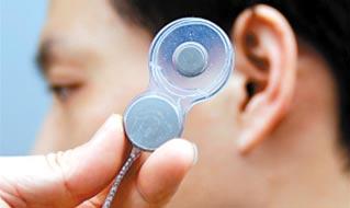重庆40名成年听障人士可免费植入人工耳蜗 解决就业难 