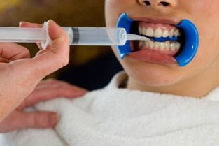 目前国内做冷光美白牙齿多少钱的 便宜吗 