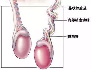 精索曲张倒致精液量少．稀．多畸形白细胞多．有何良方／