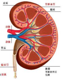 肾炎发作的特征有哪些