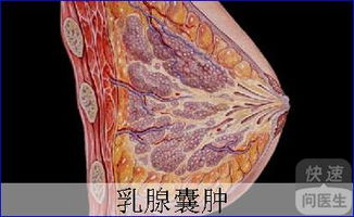 乳腺囊肿能喝豆浆吗,乳腺囊肿的病因