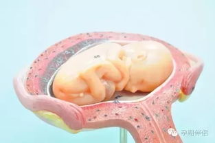 原创补钙会造成胎盘钙化吗？
