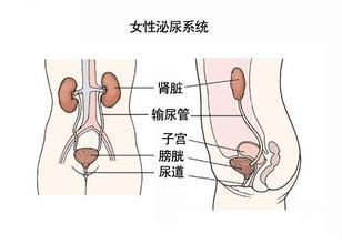 尿路感染会给身体带来的危害