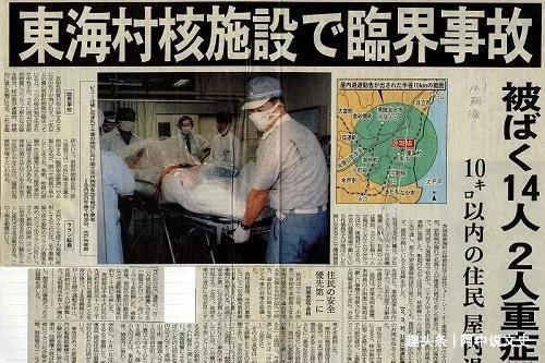 他经历了83天的身体腐烂,在一场核事故中缓慢而又痛苦地死去