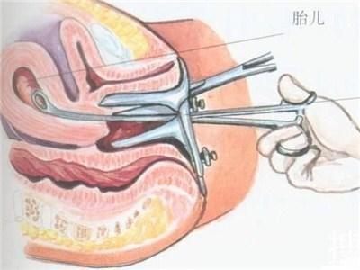 堕胎对女性身体有三大影响会伴随一生,这些副作用一定要心里有数