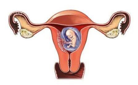 宫外孕的早期症状(宫外孕早期症状有哪些)