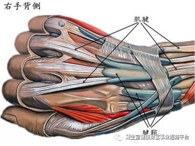 腱鞘炎怎么得的