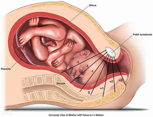 胎儿入盆是什么意思