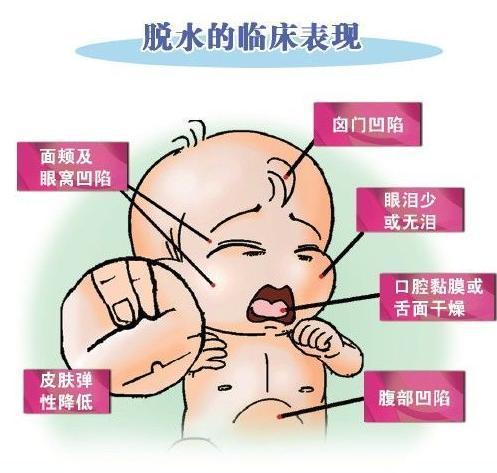 宝宝腹泻是什么症状？宝宝腹泻的症状有哪些