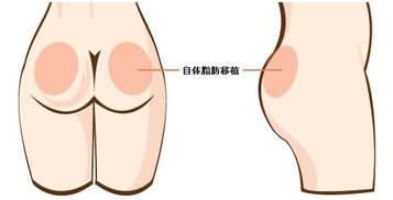 韩国奥纳比整形医院