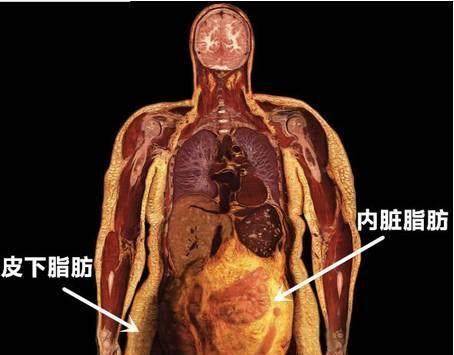 喝什么能排除内脏的油脂