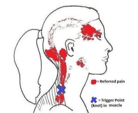 导致人们右侧肩胛骨疼痛的常见病因有哪些,如何应对 医生告诉您