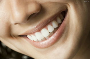 还你整齐洁白的牙齿 一般矫正牙齿多少钱