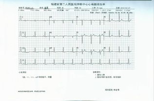 T波改变(II,III,avF低平或倒置)是什么意思