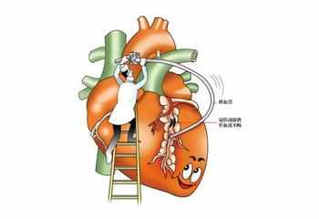 得了冠心病的人,能活多久 人各有命 支架植入12年,如今80了