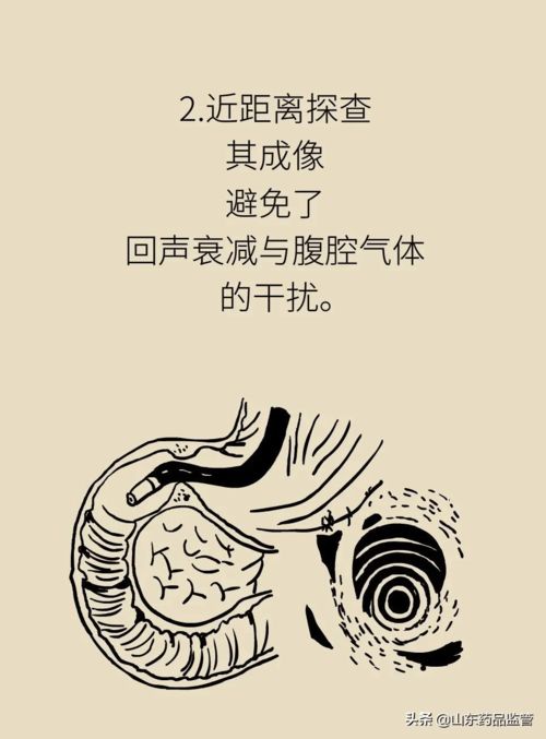 科普漫画 从地狱到天堂,改判人命运的探癌神器到底是什么