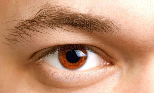 体内有癌,眼睛告知 若眼睛出现3个异样,占一个,也要尽快体检