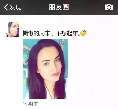 申洋 人家脚后跟都开始打玻尿酸了,你还在犹豫脸打不打玻尿酸 