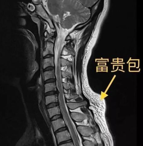 资深少女开撩小奶狗,年下恋高甜撒糖羡煞旁人 脖子 