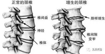 骨质增生防治功图解.苗子庆.扫描版.pdf