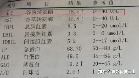 怎样看肝功能报告单，如何看肝功能化验单